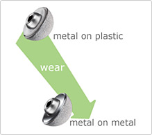 Bearing Surfaces